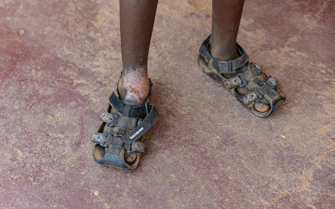 Why Shoes Matter: A Call to Action